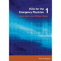 ECGs for the Emergency Physician 1: Mattu, Amal, Brady, William J