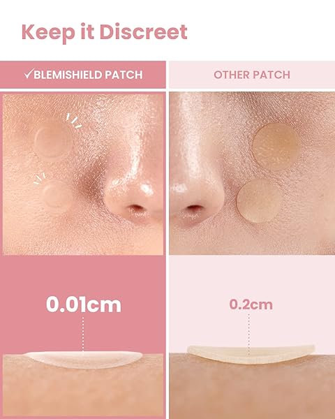 GLAM UP HYDROCOLLOID BLEMISH PIMPLE ZIT PATCHES – INVISIBLE ULTRA THIN SPOT COVER STICKERS FOR FACE AND SKIN, STRONG WATER-PROOF AND ADHESIVE OVERNIGHT, VEGAN-FRIENDLY (36 COUNT / 2 SIZES)