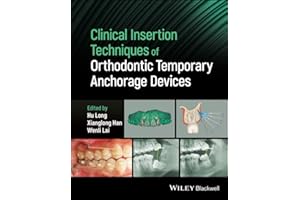 Clinical Insertion Techniques of Orthodontic Temporary Anchorage Devices