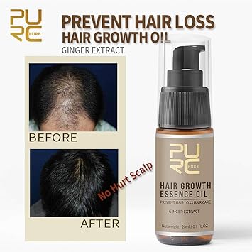 Amazon Com Capsa Hair Essence For Men Hair Spray Impact Hair Loss