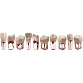 10Pcs Dental Models, Typodont, Teeth Model, Fit Kilgore Nissin 500, RCT Root Canal, Exam Pulp Cavity Practice Endodontic (M8006-10pcs Set)