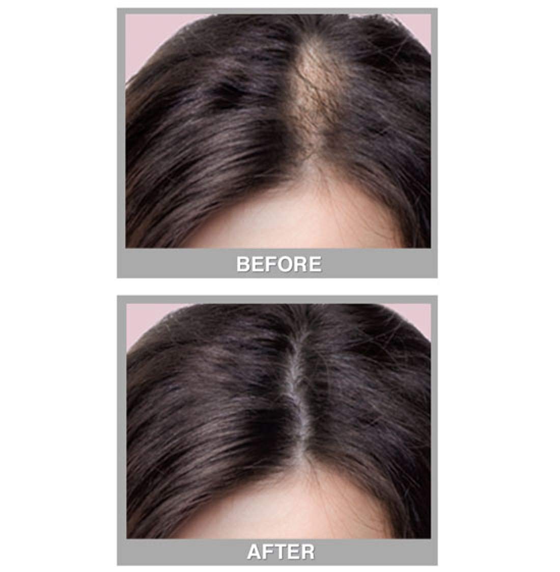Cover Your Gray Fill in Powder - Medium Brown- Root Cover Up and Hair Volumizing Powder, Hair Filler For Thinning Hair, Root Touch Up Powder, Instantly Fills In Thinning Areas : Hair And Scalp Treatments : Beauty