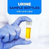 One Step 50 x 30ml Urine Sample Pots Specimen Containers Graduated with Lid & view 3