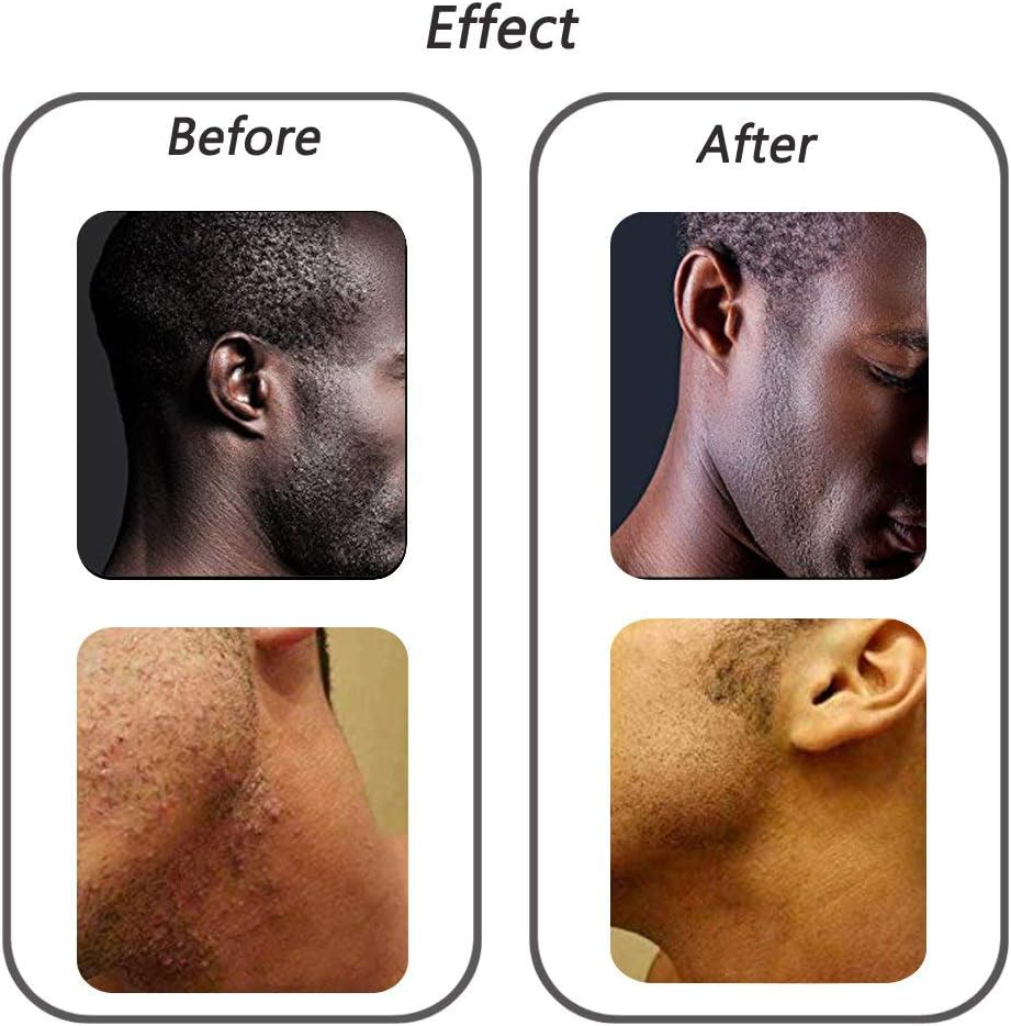 Amazon Com Vaorwne Exfoliating Brush Body Brush Eliminate Shaving