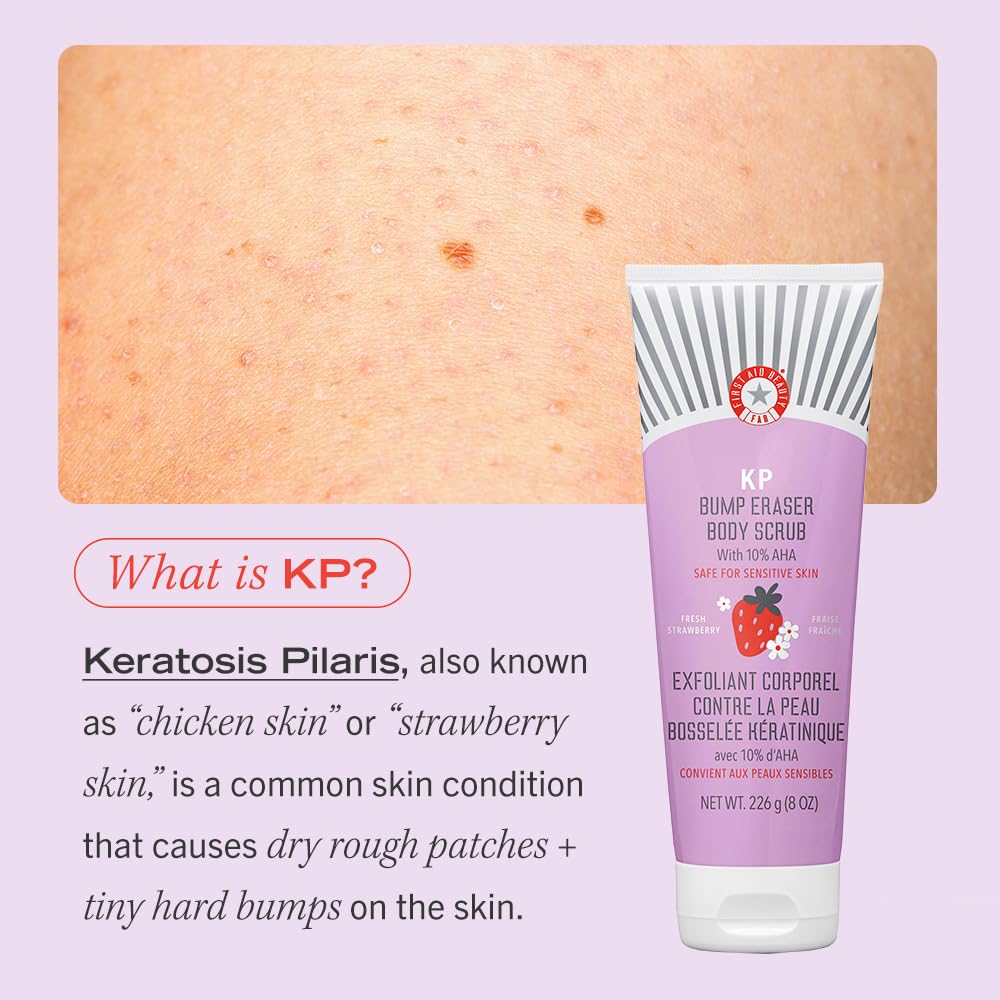 First Aid Beauty - KP Bump Eraser Body Scrub with 10% AHA, Keratosis Pilaris Exfoliater with Glycolic and Lactic acids, Helps Reduce Chicken Skin Bumps, Safe for Sensitive Skin, Strawberry Scent, 8 oz - Image 8