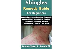 Shingles Remedy Guide for Beginners: Detailed Guide on Shingles; Causes & Known Signs; Diagnosis & Efficient Treatment Includ