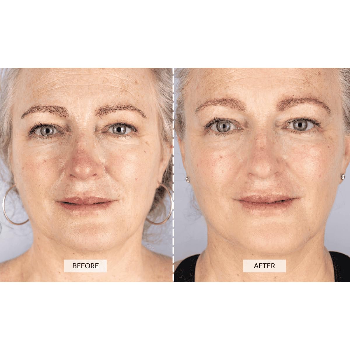 CurrentBody Skin LED Mask - image 3