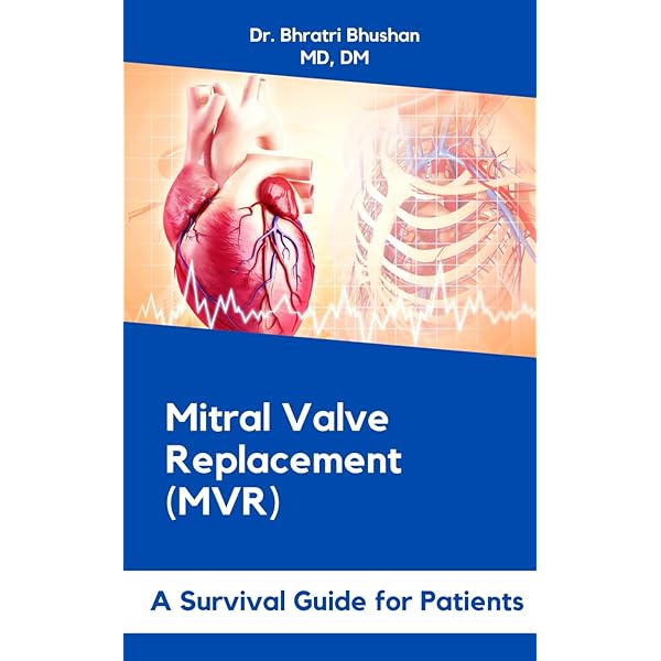 カーペンティアReconstructive valve surgery Carpentier's Reconstructive Valve Surgery: 9780721691688: Medicine