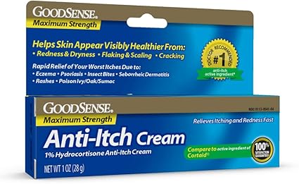 Best anti itch cream for bug bites