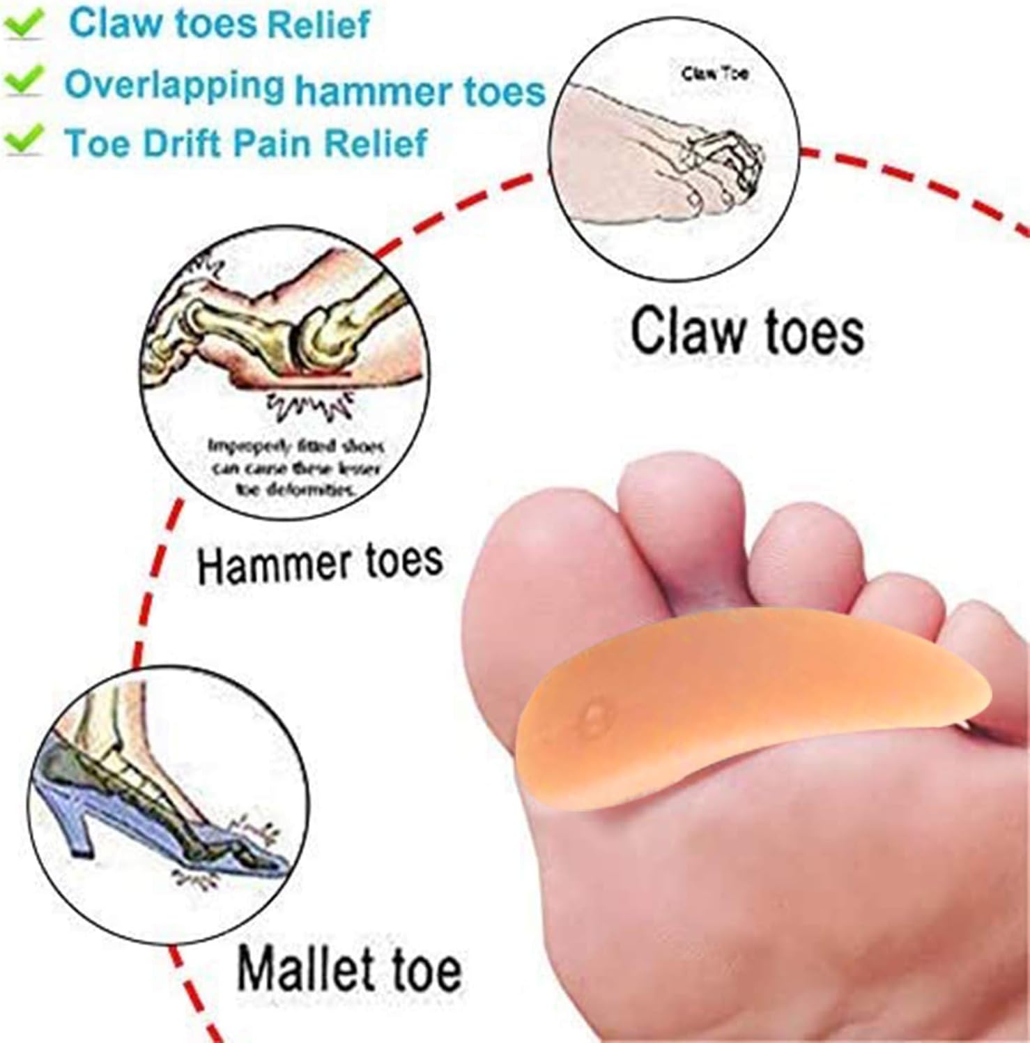 Mcvcoyh 10 Pieces Hammer Toe Cushions for Toes Toe Crests Pads, Gel Spacer Pads for Overlapping Toe Prevent Shoe Friction Curled Toes - Image 5