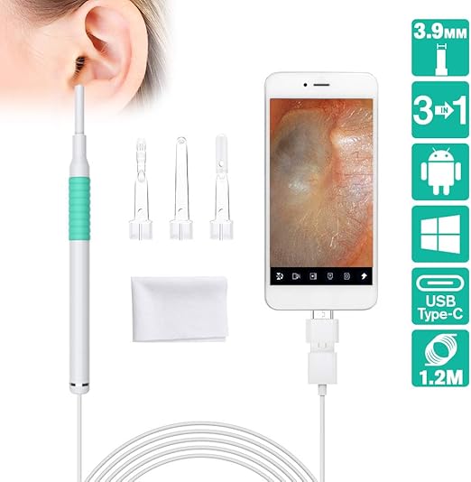 ROTEK USB Otoscope, 3.9mm Ear Endoscope 1.3 Megapixels Amazon.co.uk