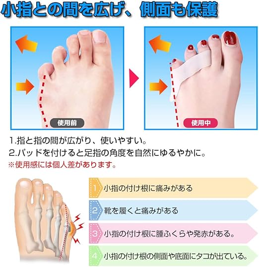 Amazon 内反小趾 サポーター 小指 矯正パッド 靴ズレ防止 小指ジェルパッド 内反小趾グッズ 予防 足指広げケア 足指セパレーター 小指痛み緩和 フットケア 2足4個セット 3本指 Bhcanae 外反母趾 内反母趾用