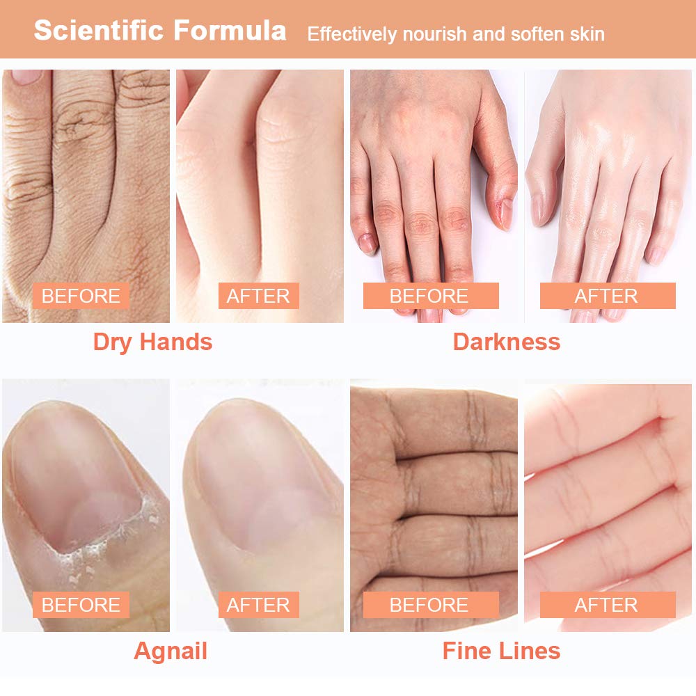 FANSITY 5 Pack Moisturizer Hands Mask of Mother's Day gift, Infused Goat Milk Natural Therapy Hand Spa Mask ,Improve for Dry, Cracked Skin Hands Moisturizing Gloves, Repair Rough Skin for Women&Men: Beauty