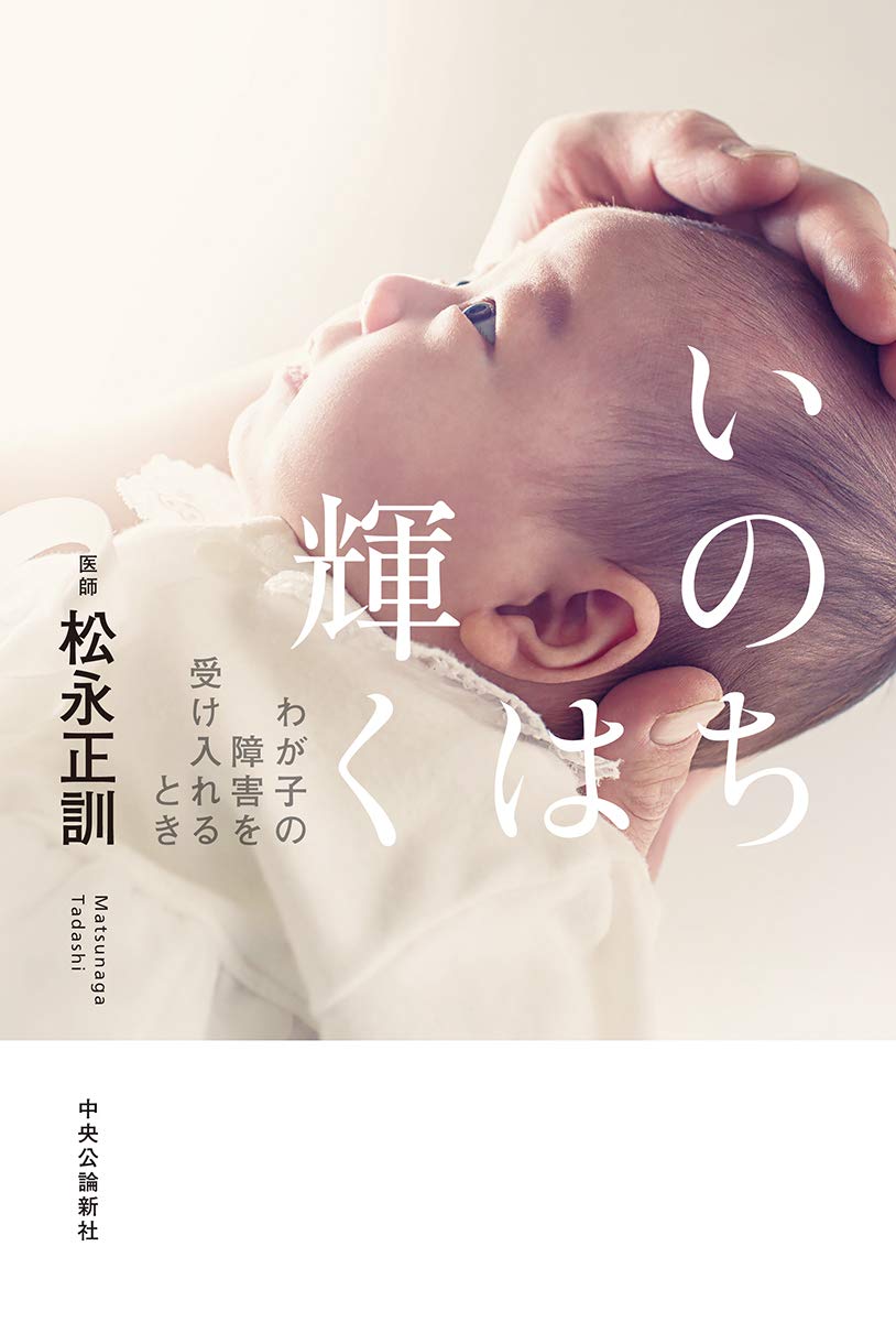いのちは輝く わが子の障害を受け入れるとき 単行本 松永 正訓 本 通販 Amazon