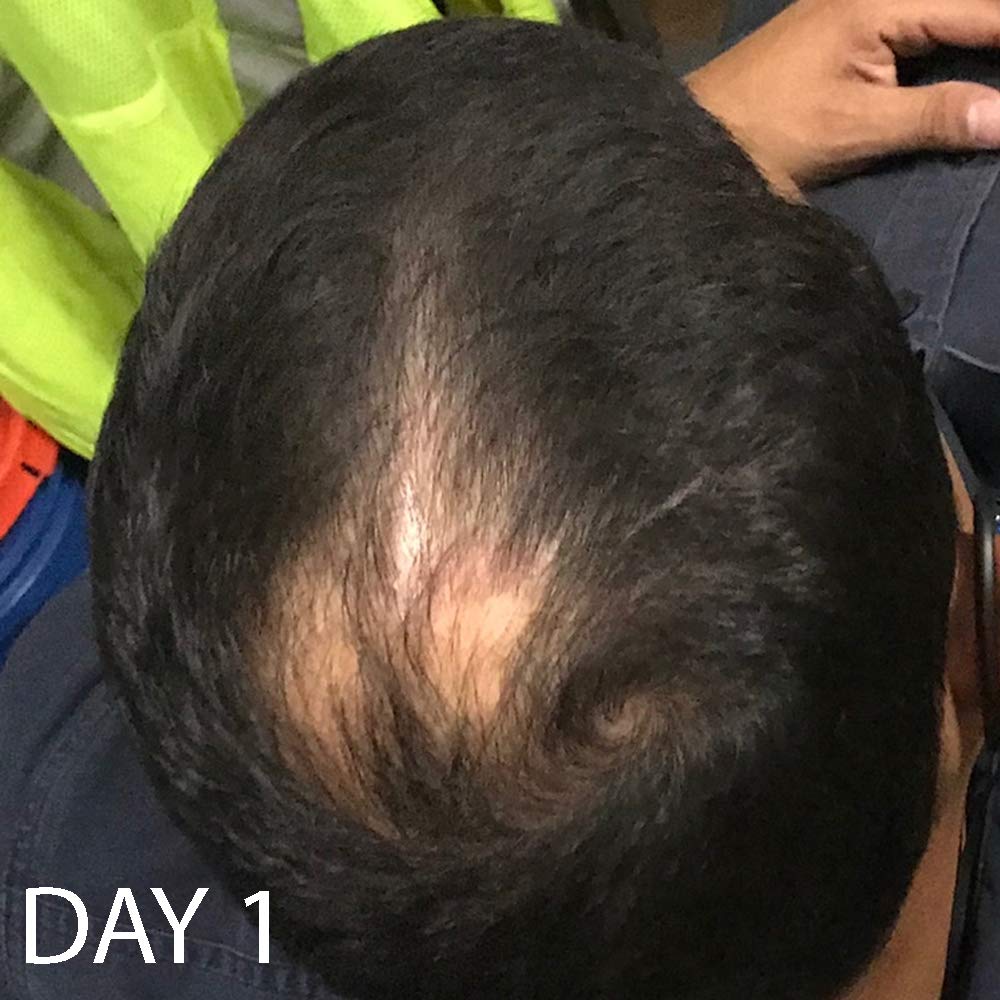Biotin Vitamin Hair Growth Conditioner-(High Potency) Biotin Conditioner For Fastest Hair Growth, Anti Hair Loss Conditioner, Vitamins E, A, And C, B. THE PRODUCT: Beauty