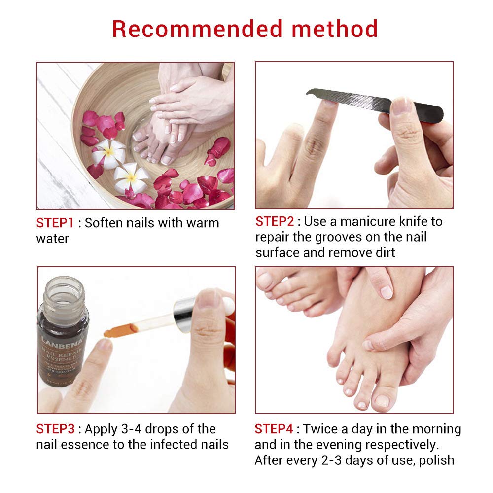 lanbena nail repair