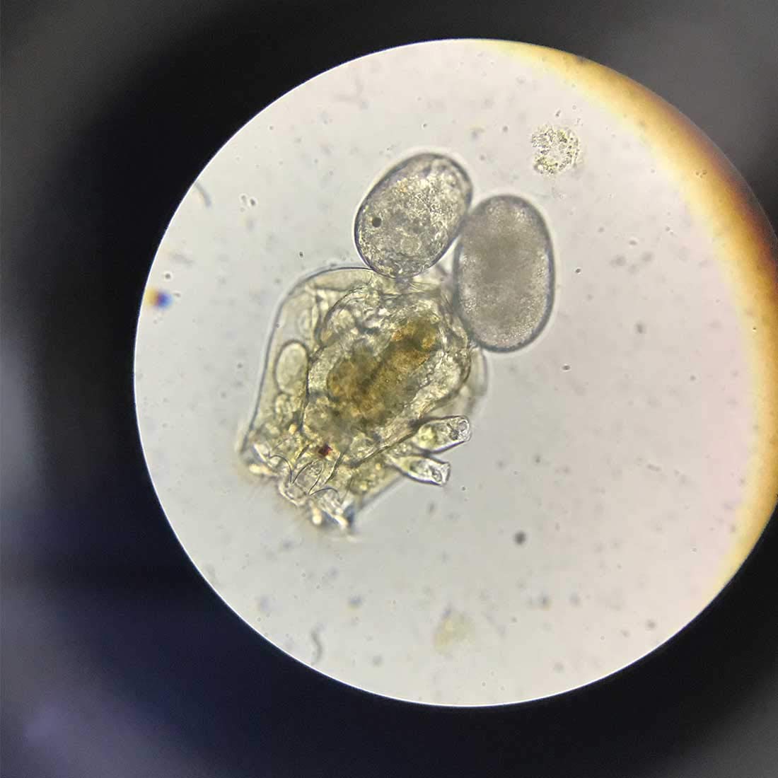 GreenWaterFarm Rotifers Brachionus calyciflorus Pallas Eggs Live Fish Food for Hatching and Culture Suitable for Feed Betta Fish