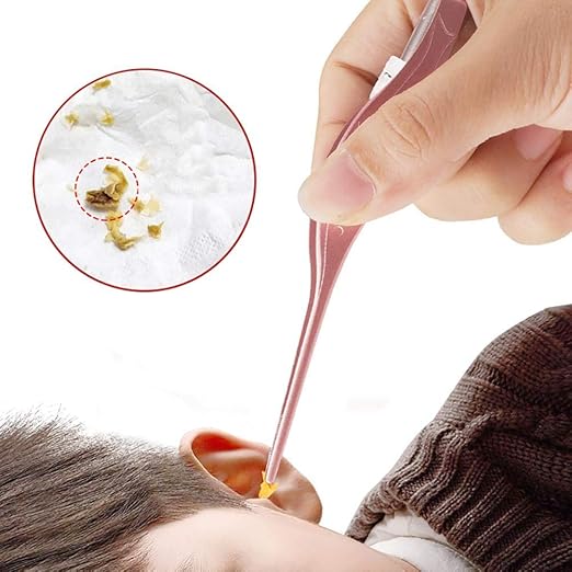 Eillybird Ohrenschmalzentferner Ohr Reinigung BeleuchteteWerkzeug Ohrclips Ohrlöffel Ohrenpflücken Für Kinder Ohrenreiniger O