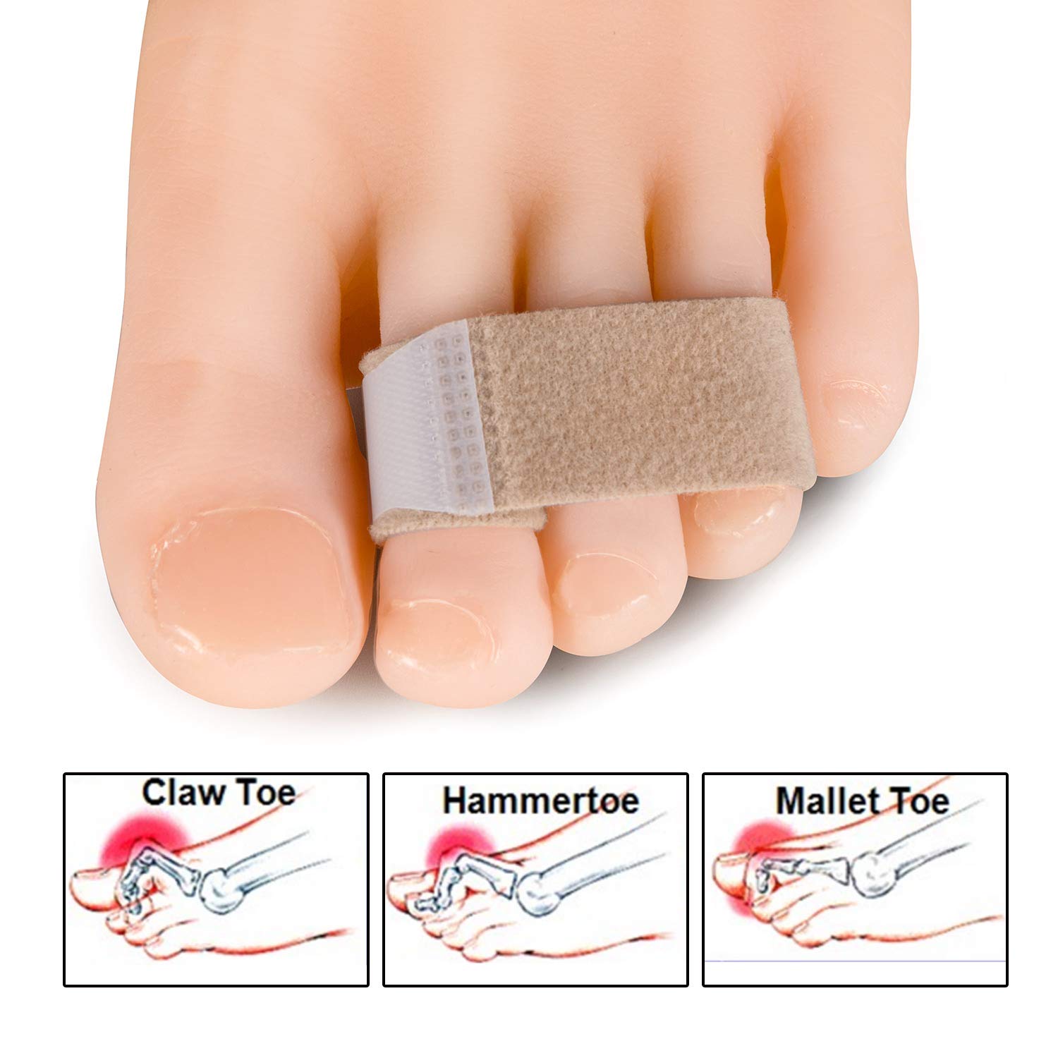 Welnove Toe Splints Straightener Toe Tape Bandages 10 Pcs Toe Brace