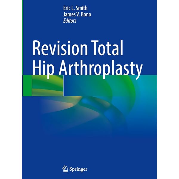 Essentials in Total Hip Arthroplasty: 9781556428708: Medicine