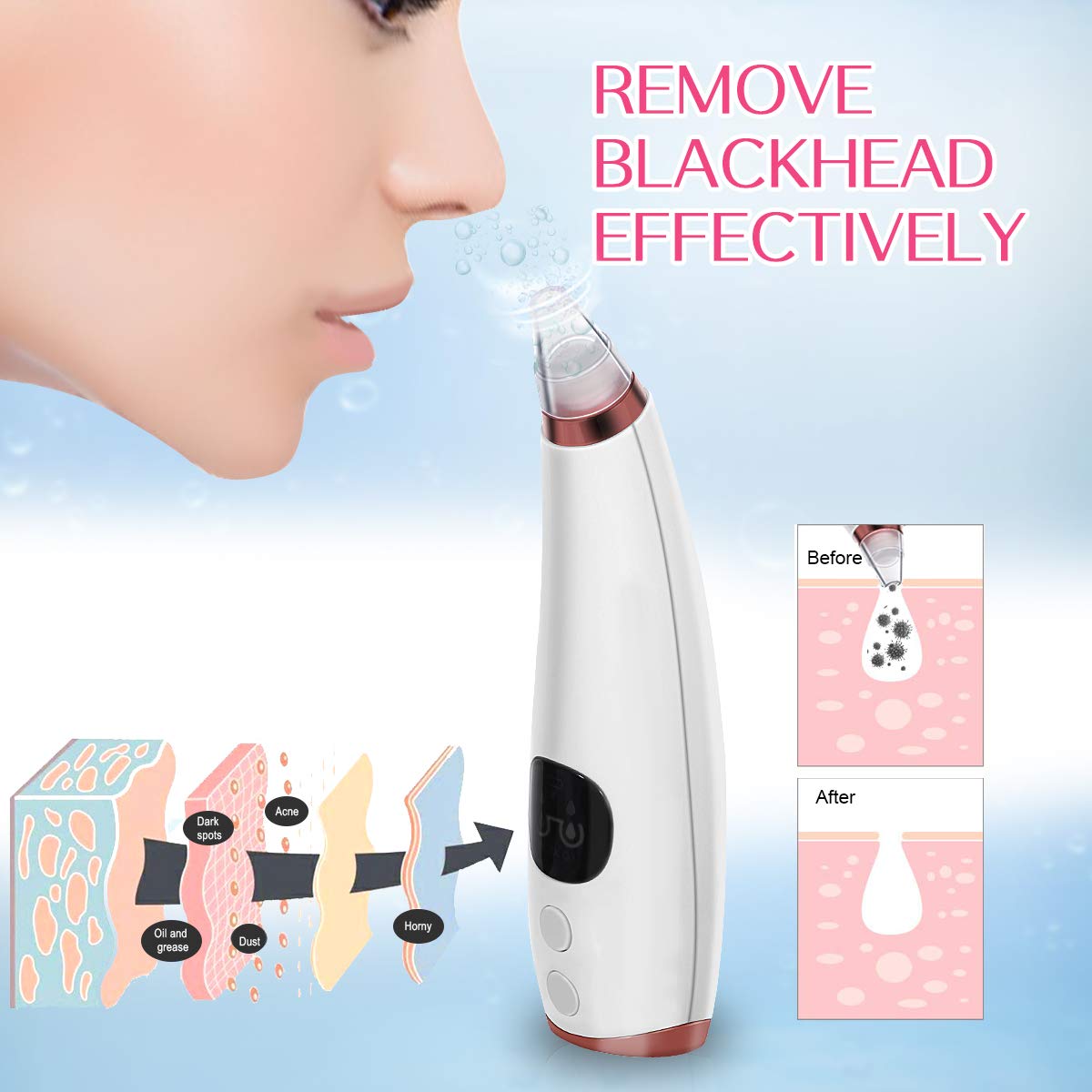 Blackhead Remover Vacuum with 5 Suction Heads,Pore Vacuum USB Rechargeable,Acne Comedone Extractor Kit,3 Adjustable Suction Force,LED Display,Facial Pore Deep Cleaner for Men and Women