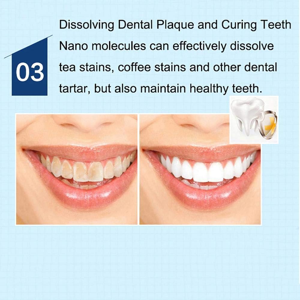 Teeth Whitening Pen, Safe 35% Carbamide Peroxide Gel, 20+ Uses, Painless, No Sensitivity, Easy to Use, Natural Mint Flavor