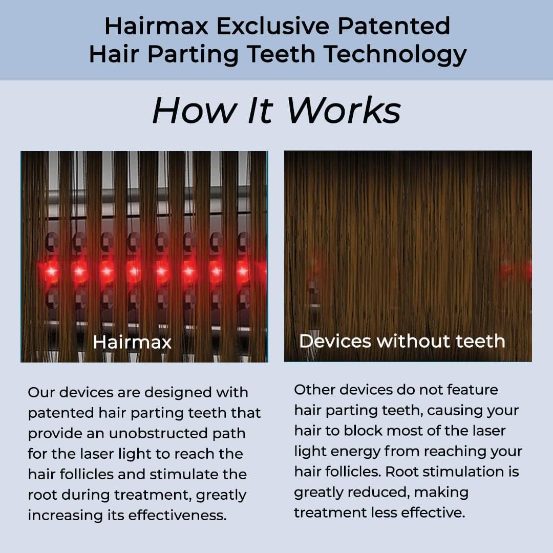 Hairmax LaserBand 82 - Hair Growth and Regrowth Treatment - Restores Natural Hair Cycle - Home-Use Medical Device With Medical Grade Lasers