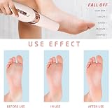 BEIIEB Electric Foot Grinder Rechargeable Waterproof Callus Remover Hard Skin view 4