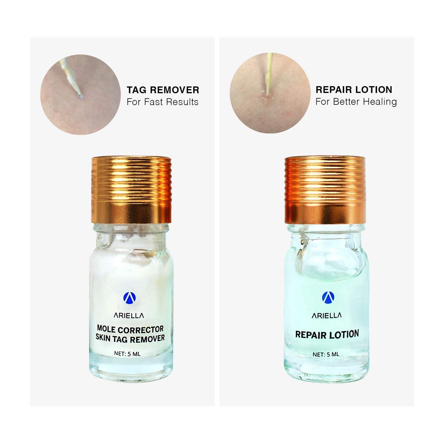 Ariella Mole and Skin Tag Remover and Repair Lotion Set, Remove Moles and Skin Tags : Beauty