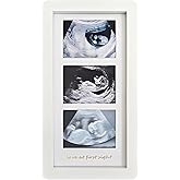 trlry Love at First Sight Ultrasound Picture Frames,Triple Ultrasound Picture Frames,Sonogram Picture Frame 3 Photos,Pregnancy Announcements (White)