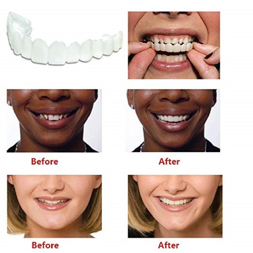 Diaper White Oral Denture Teeth Whitening Cosmetic Upper Veneer Denture Teeth Temporary Smile Dental Care