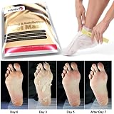 Infinitive Beauty Foot Peel Mask Socks 2 Pairs - Exfoliating Callus Remover for view 6