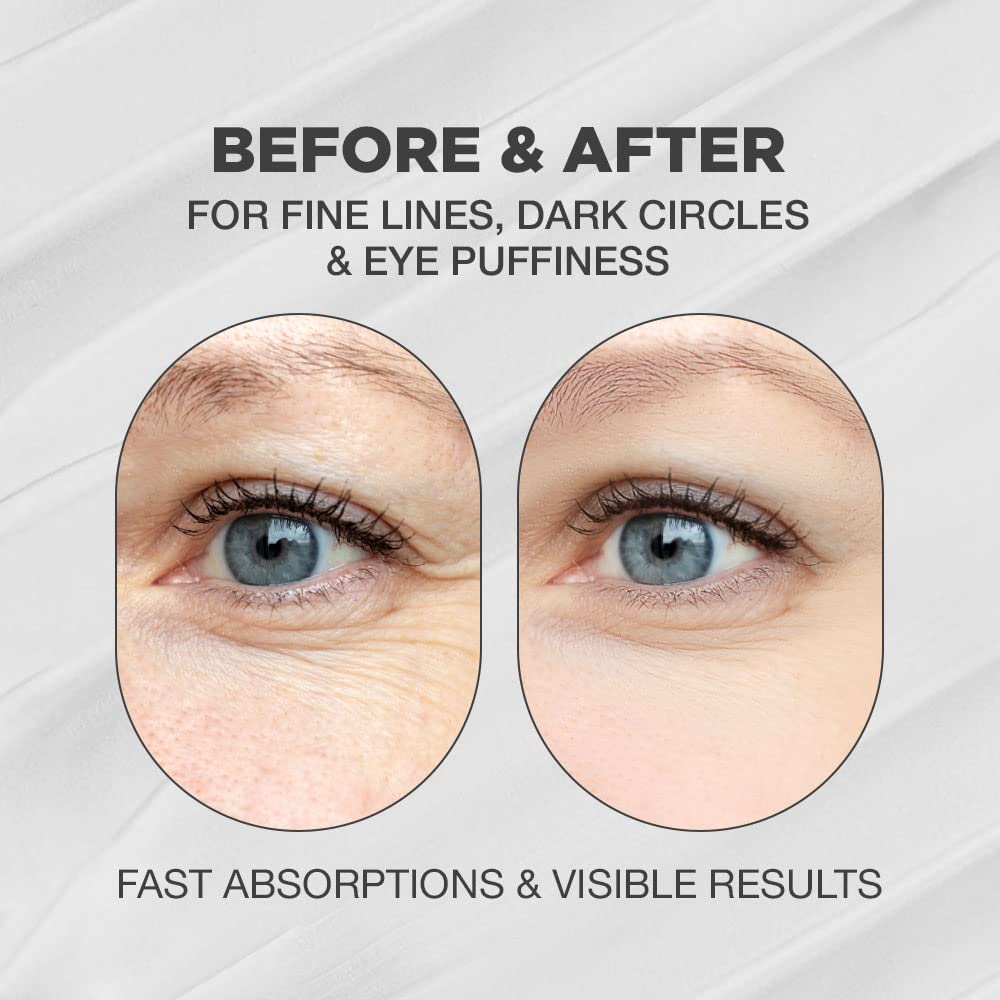 Snail Eye Cream | Advanced Snail Mucin Eye Cream | Snail Mucin Eye Cream | Snail Mucin Eye Cream with High Concentrate of Snail Secretion Filtrate | Snail Eye Cream with Natural and Innovative Complex | Korean Moisturizer Snail Eye Cream with 96% Snail Mucin Extracts | Snail Eye Cream for Sensitive and All Skin Type | Formulated with Snail Mucin, Centella Asiatica, Rosemary and Other Natural Ingre