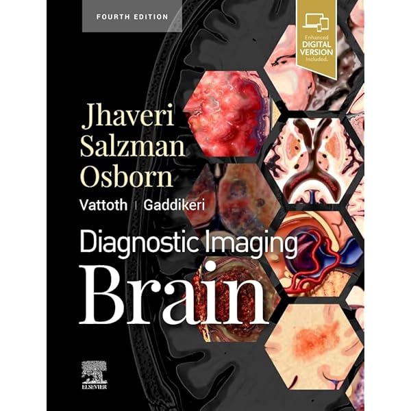 ExpertDDx: Brain and Spine: 9780443106941: Medicine & Health