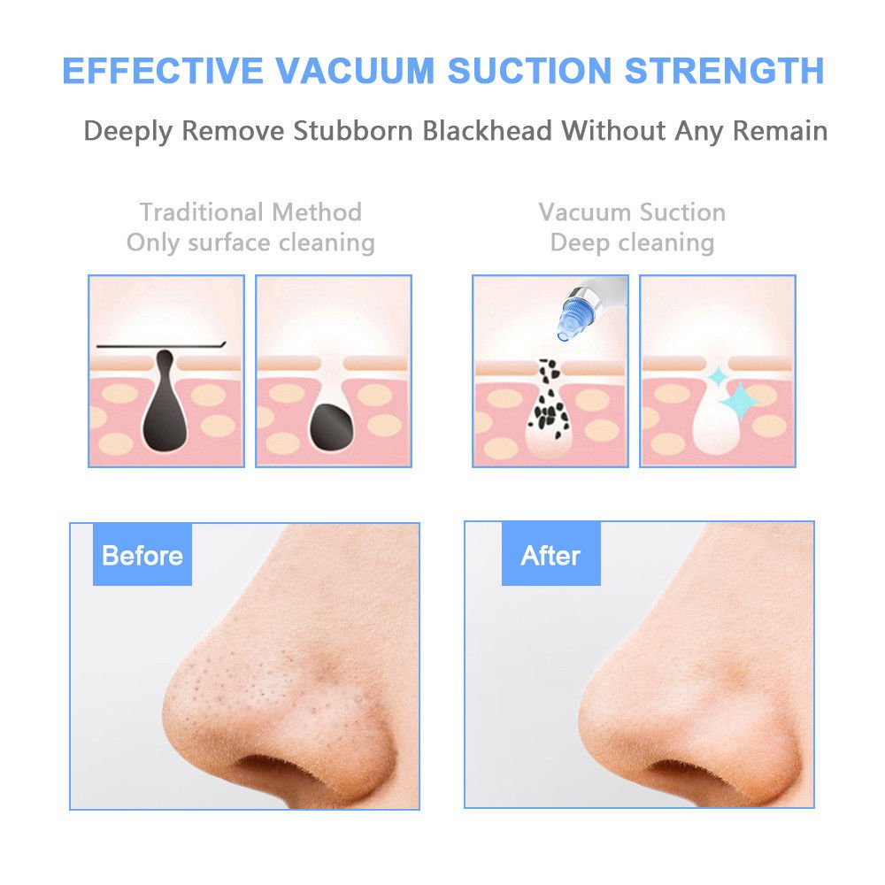 Electric Blackhead Remover -Wivarra Vacuum Blackhead Suction USB Rechargeable Extractor Tool with 4 Multi-Functional Probe,Microdermabrasion Comedone Machine for Acne and Facial Pore Clean