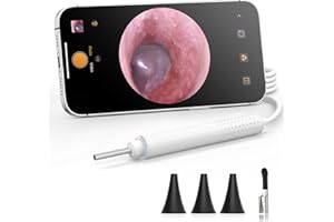 ScopeAround Otoscope with Light, 720P HD Ear Cleaning Camera & 6 LED Lights Ear Scope, Digital Otoscope with Camera, Smart Endoscope, Plug & Play, USB-C Port