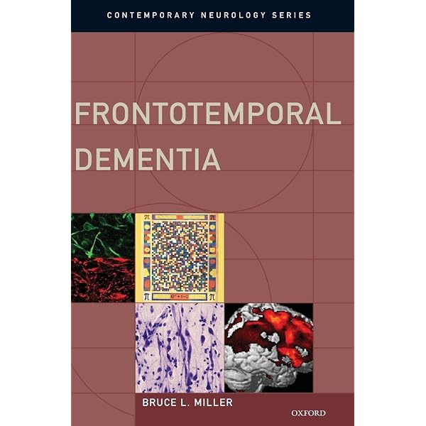 Plum and Posner's Diagnosis and Treatment of Stupor and Coma