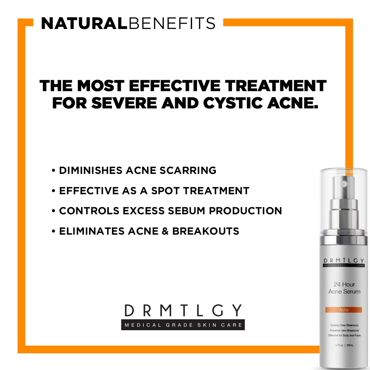 cystic acne serum