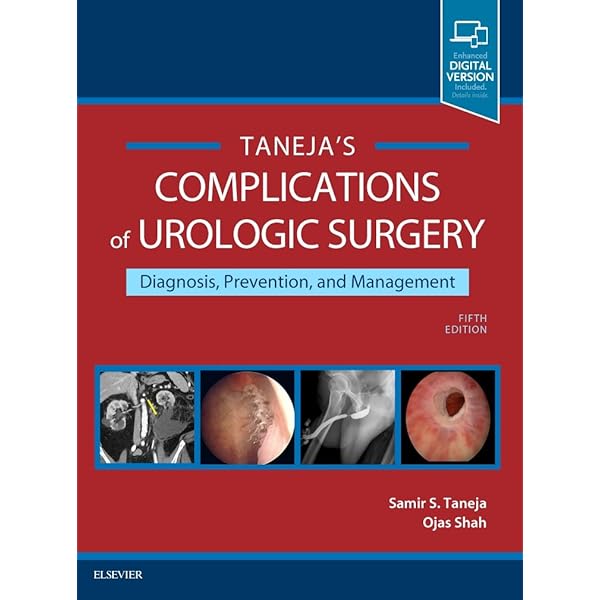 Hinman's Atlas of Urologic Surgery Revised Reprint | Amazon.com.br
