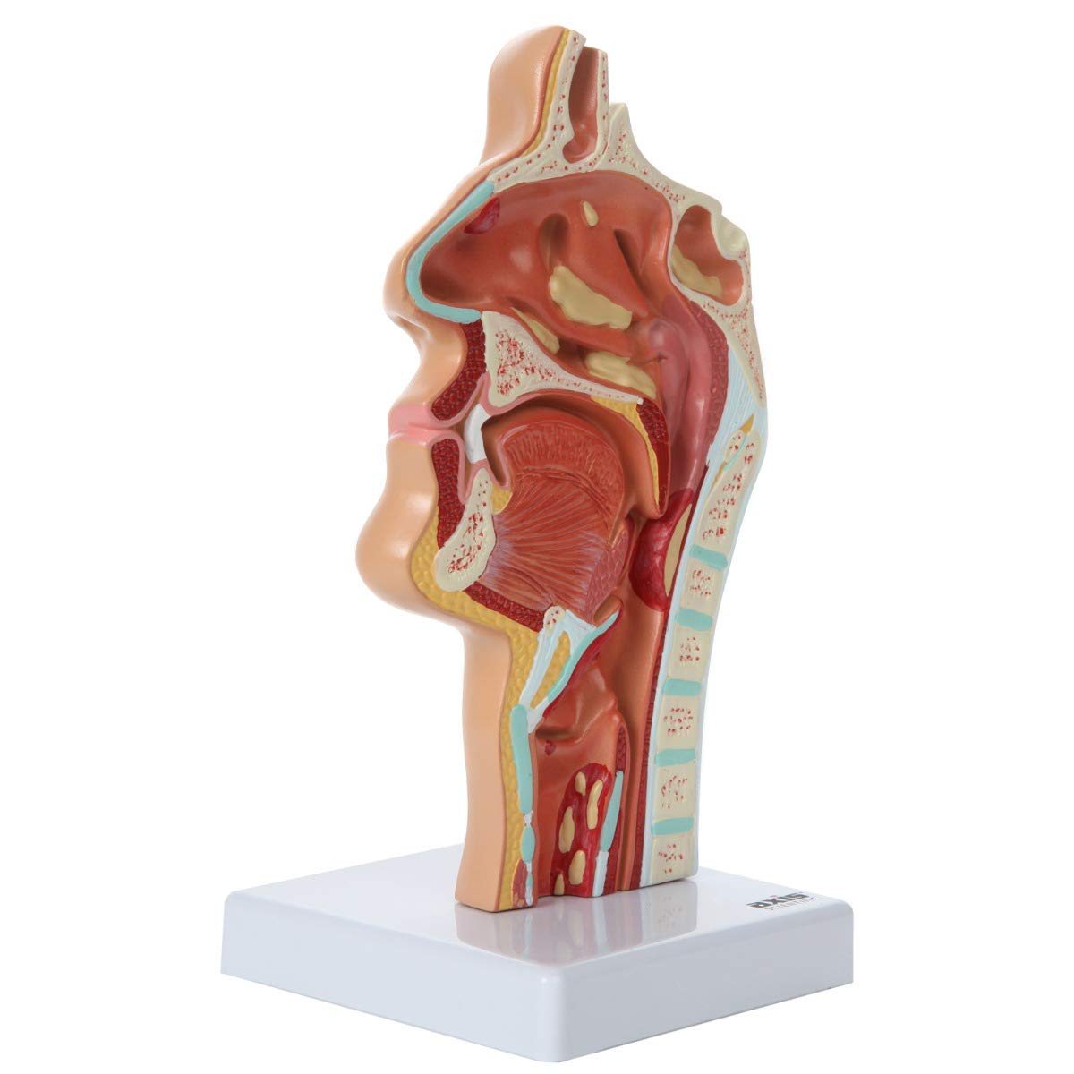 Axis Scientific Human Larynx and Pharynx Disorders Model | Shows Normal Larynx and Pharynx Anatomy and Details Common Abnormalities | Comes on White Base