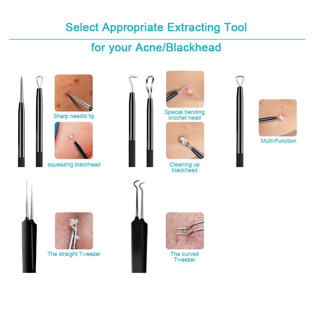 Blackhead Remover Tool,Sedremm 5 in 1 Acne Pimple Extractor Stainless Steel Tweezer Kit with Mirror and 10 PCS Alcohol Cotton Pads Treatment for Zit Comedone Whiteheads Blemish Removal
