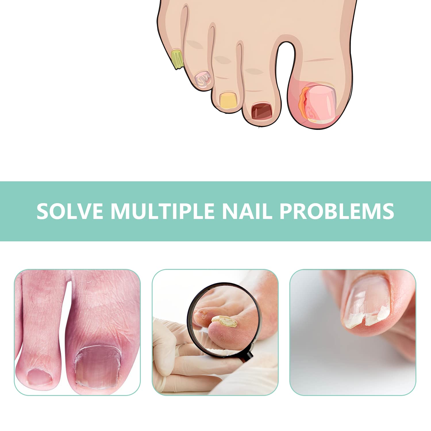 3Pack NAIL LIQUID Kerassentials, Kerassentials Oil,Kerasentials Nail - Image 3