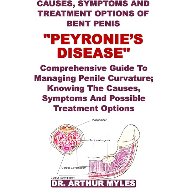 l carnitine for peyronie's Can penis bigger peyronies supplements actually help with curvature and  size concerns? main image 1