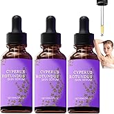 LOYOTICE 3Pcs Cyperus Rotundus Skin Serum, Cyperus Rotundus Oil for Hair Removal, Natural Organic Moisturizing Soothing Body Oil, Balances Skin Tone, Reducing Body Hair