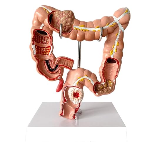 RRGJ Teaching Model, Human Large Intestine Anatomical Model Visceral ...
