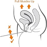 Neen Periform Intra-Vaginal Probe Pelvic Floor Stimulation Contoured Electrodes view 4