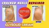 Glysolid Glycerin Cream 125ml Allantoin for Dry Skin - European Formula view 4