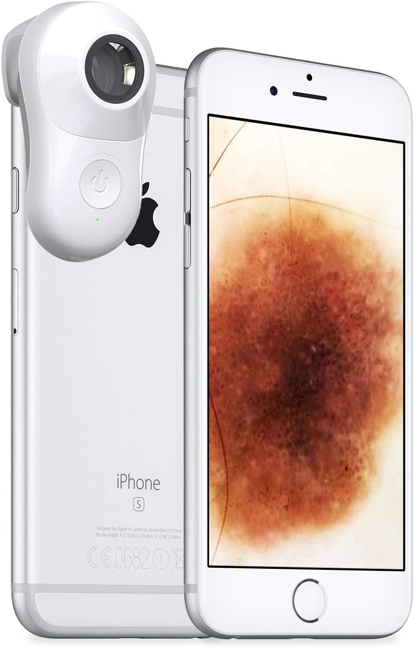 MoleScope II (Professionals) - Smartphone Attachable Dermoscope (iPhone XR)