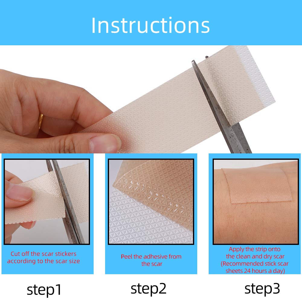Professional Soft Silicone Scar Sheets, Prevents & Treats All Scars, Soften and Flattens Scars Resulting from C-section, Surgery, Injury, Burns, Acne, 5.9"×1.38", 5 Sheets(5 Months Supply)… : Beauty