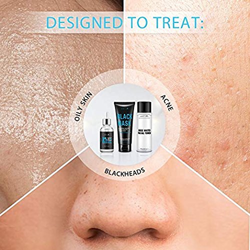 Aprilis Blackhead Remover Set, Scientific 3-Step Solution, Skin Exfoliant, Black Mask and Firming Facial Toner for Removing Blemishes & Blackheads, Radiant Skin Treatment